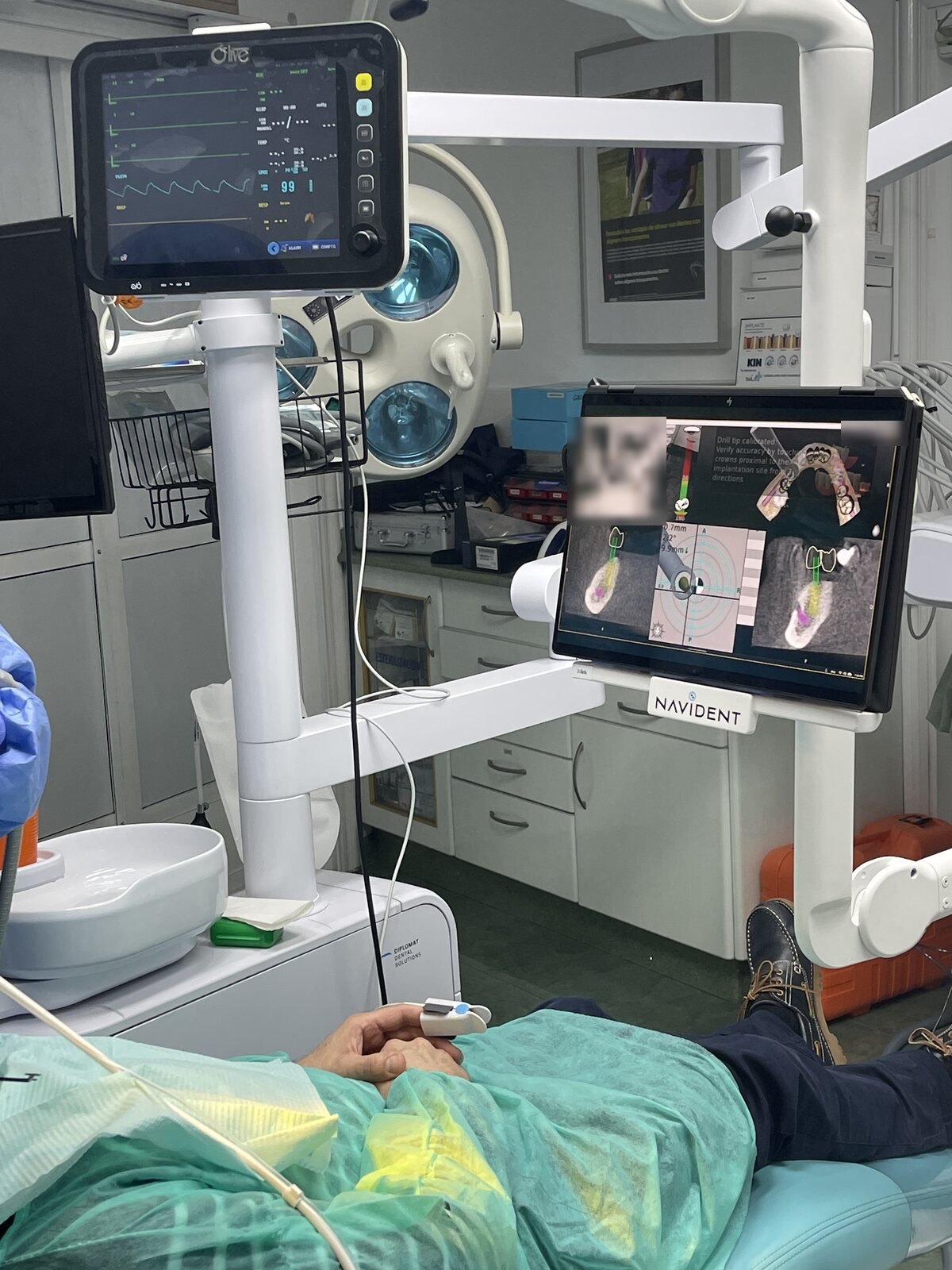 Cirugía de implantes con el sistema de navegación Navident en el gabinete de Dental Balea